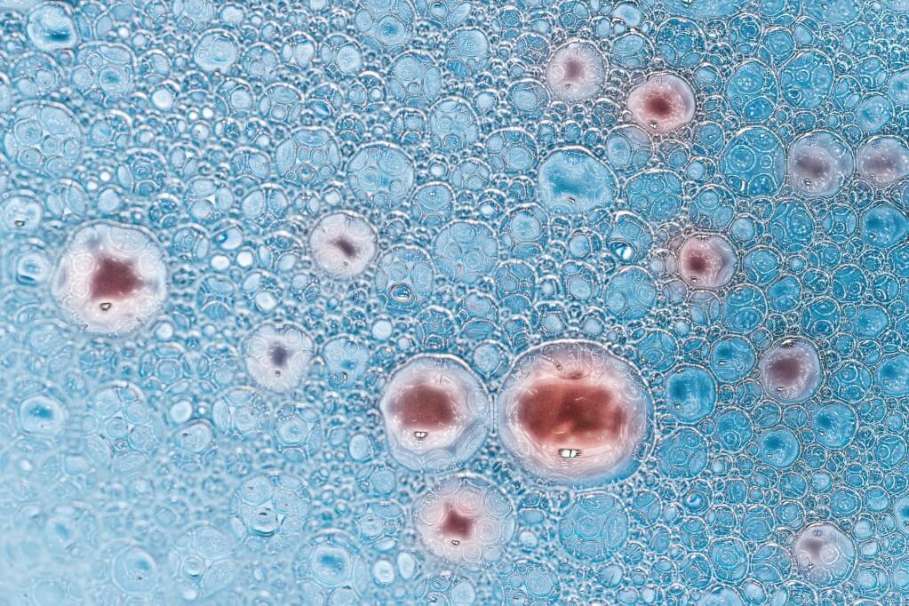 infection-particles-antibodies-antibody-strand-testing-scan-xray-spread-morph-microbiology-biology_t20_drrP09 (1)